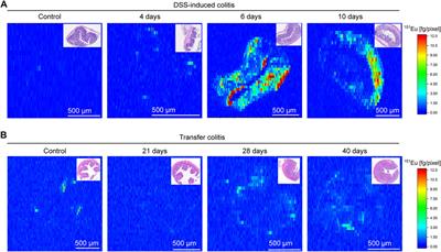 Visualization of Inflammation in Experimental Colitis by Magnetic Resonance Imaging Using Very Small Superparamagnetic Iron Oxide Particles